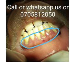 dental oral care
